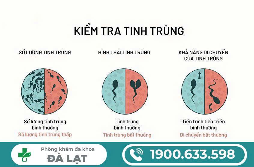 Hình ảnh minh họa